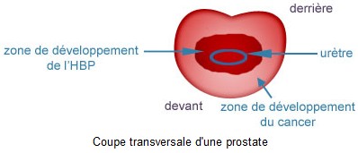 Coupe transversale d'une prostate