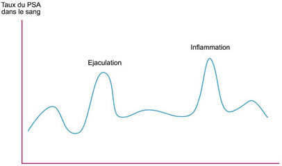 Taux du PSA dans le sang